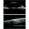 Microscopio de biomicroscopia ultrasonido para los ojos.